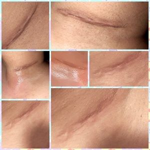 Bálsamos caléndula